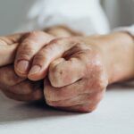 آرتریت پسوریاتیک