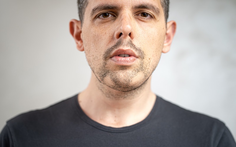 دلیل ریزش سکه ای ریش