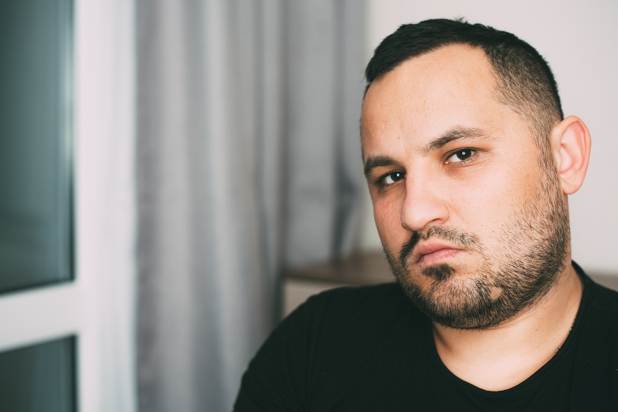 ریزش سکه ای ریش