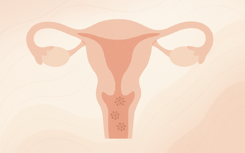 زگیل تناسلی و بارداری