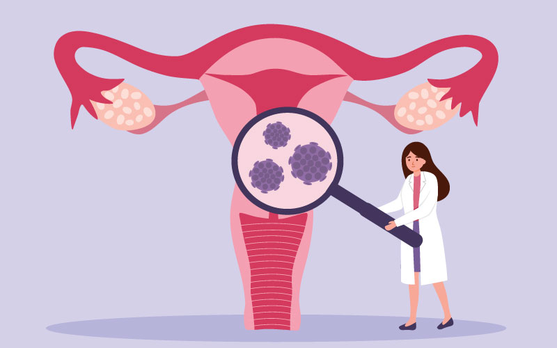 انتقال زگیل تناسلی