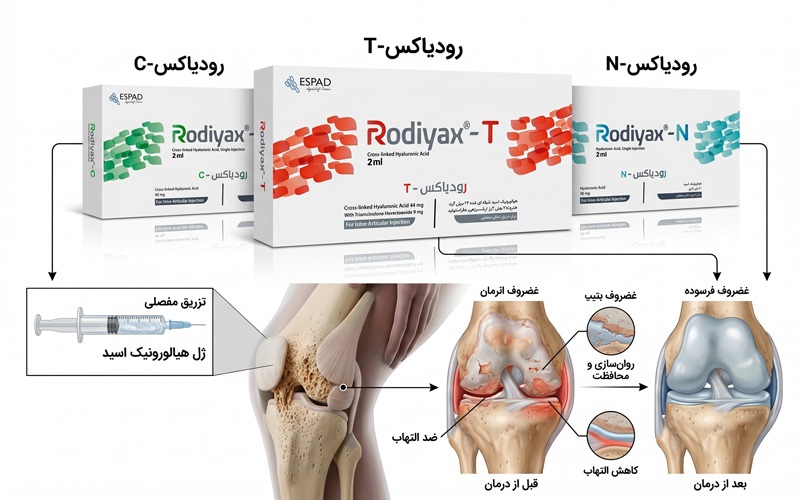 تزریق داروی رودیاکس برای درمان آرتروز