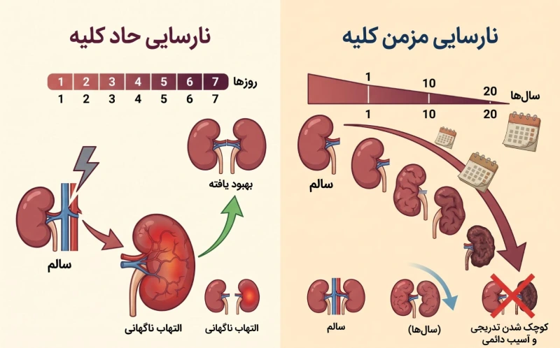 اینفوگرافیک مقایسه تفاوت نارسایی حاد و مزمن کلیه از نظر سرعت پیشرفت و بازگشت‌پذیری