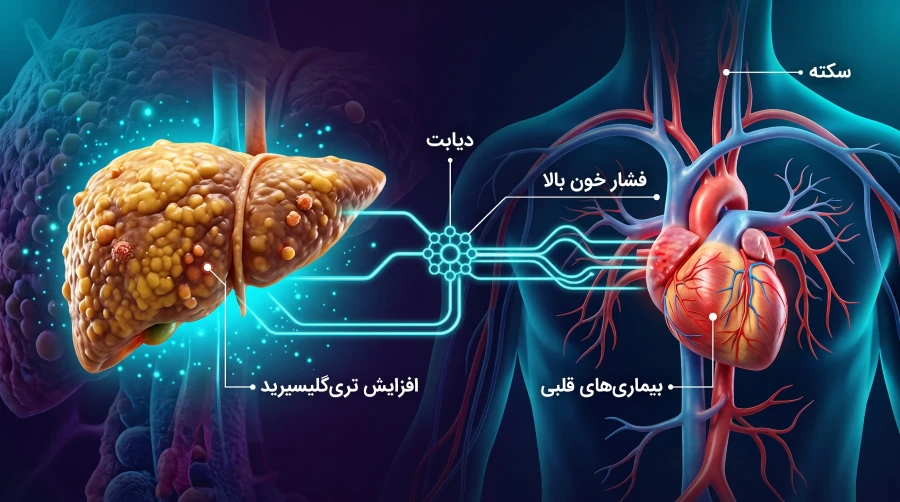 اینفوگرافیک پزشکی ارتباط کبد چرب با سندرم متابولیک، دیابت، فشار خون بالا، افزایش تریگلیسیرید و خطرات قلبی-عروقی