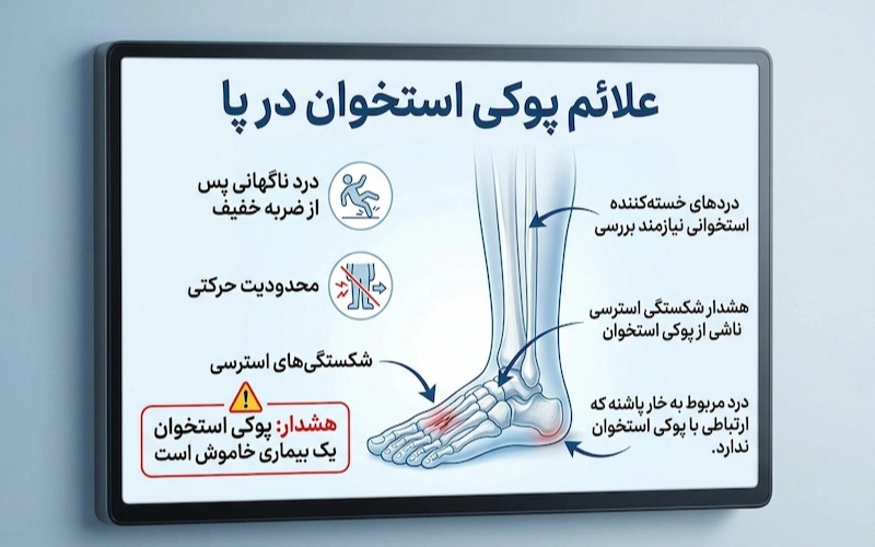 پوکی استخوان در پا