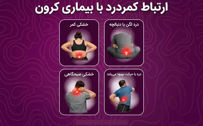 ارتباط کمردرد با بیماری کرون؛ درد لگن و دنبالچه، خشکی کمر و خشکی صبحگاهی
