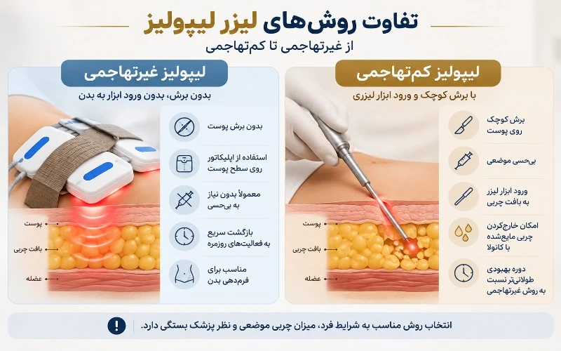 تفاوت لیزر لیپولیز با لیپولیز غیرتهاجمی